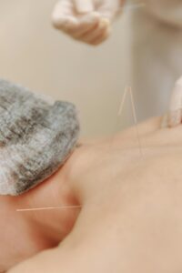 Acupunctura: o tradiție chinezească de bunăstare si armonie